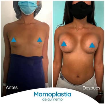 Slider image (5) Dr. Alvaro Uribe - Plastic Surgery in Colombia